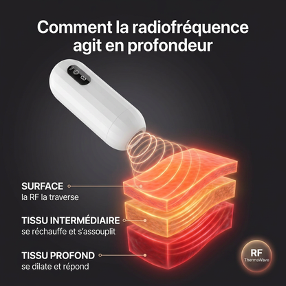 Vireon Pro — Comment la radiofréquence agit en profondeur